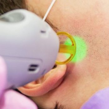 a-medical-specialist-performs-a-laser-hair-removal-HCD4NY5-scaled-pdsxjtplbohjfozfh5atnwggjcja418pucyugyrnog a-medical-specialist-performs-a-laser-hair-removal-HCD4NY5-scaled-pdsxjtplbohjfozfh5atnwggjcja418pucyugyrnog