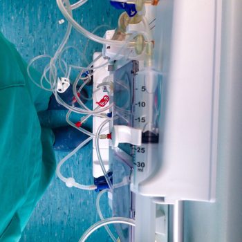 preparing-the-dialysis-machine-on-saturday-afterno-JRQVKTG-scaled preparing-the-dialysis-machine-on-saturday-afterno-JRQVKTG-scaled